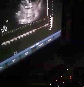 12 Weeks Pregnant Heather Deep Thai teen 18+ gets facial