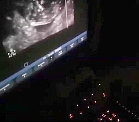 12 Weeks Pregnant Heather Deep Thai teen 18+ gets facial