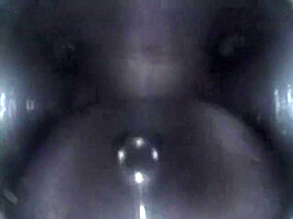 Mouthcam Sapphire