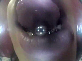 Mouthcam Sapphire