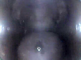 Mouthcam Sapphire