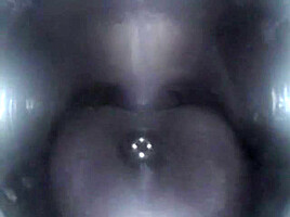 Mouthcam Sapphire