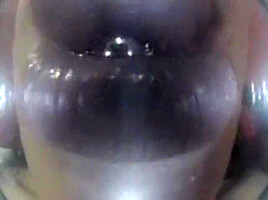 Mouthcam Sapphire