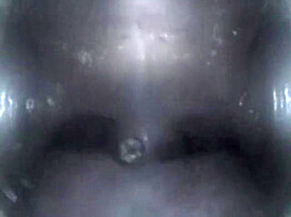 Mouthcam Sapphire