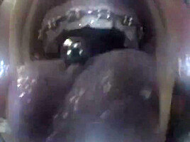 Mouthcam Sapphire