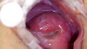 vagina,closeups,internal pussy,speculum,naughty nurse,uniform,spreading,gap